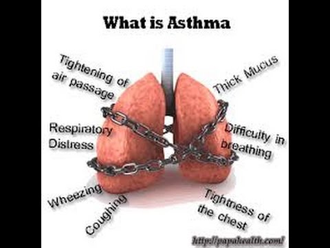 NATURAL HOME REMEDIES FOR ASTHMA