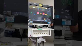 Philips Monitor Upgrade keypoints(3)