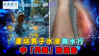深圳男子水浸澗水行 中「丹毒」險送命 ｜ 日本命力呈獻: 健康關注組 ｜ EP383 ｜ 丹毒 ｜ 皮膚病 ｜ 甲類鏈球菌 ｜ 敖嘉年 ｜ 黃芳雯 ｜ HOY TV 77台