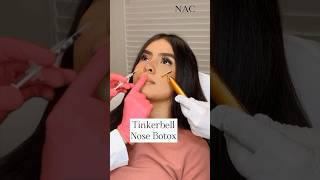 Tinkerbell Nose Botox #botox #nosebotox #drbitafarrell