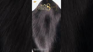 Redefine your scalp care with every drop of Dove Scalp + Hair Therapy Scalp Serum.​