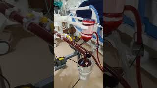 ECMO machine #hospital #medicalhealthcare #shorts #ecmo #ecmomachine #doctor #icudoctor #doctor