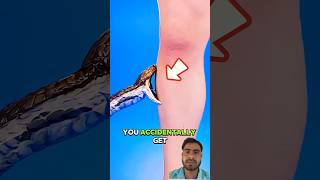 Do You Know First Aid for a Snake Bite? #youtubeshorts #shorts #ytshorts  #bite #snake #snakebite