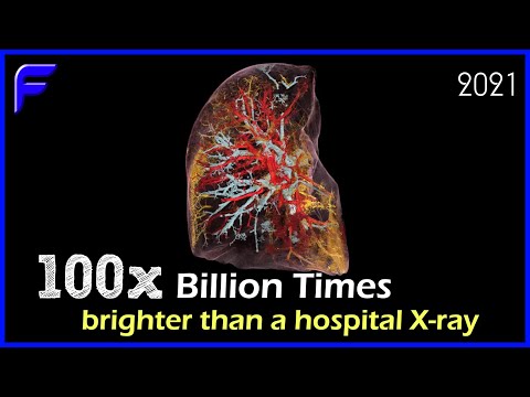 World’s Brightest Ever X-Ray Shows Images Up to One Micron! | Futuristic Medical Advancements 2021