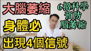醫生警告：大腦「萎縮」前身體必現4個信號！第3個最易忽略！6類人最易腦萎縮！第1種幾乎人人中招，50歲後快自查！