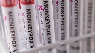 DC Health Department launches monkeypox dashboard