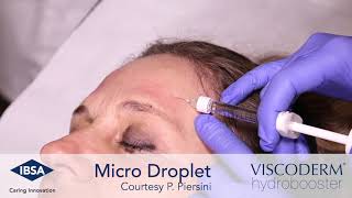Viscoderm Hydrobooster Microdroplet  Technique Forehead Area