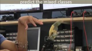 Thought controlled arm