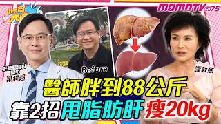 醫師胖到88公斤!! 靠2招甩 脂肪肝 瘦20kg ft. 梁程超 醫師  譚敦慈【 小宇宙大爆發 】