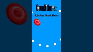 Target Cells in Hematology | What is Wednesday | IvyPDC #Shorts #WhatIsWednesday #MedTech