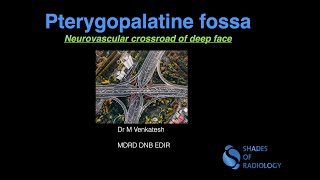 Pterygopalatine fossa - Simplified