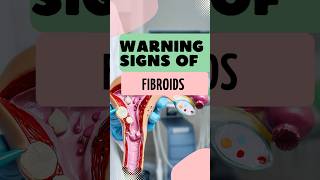 Warning Signs of Uterine #Fibroids #shorts