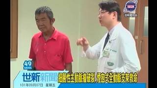 世新新聞 細菌性主動脈瘤破裂 煙囪式全動脈支架救命