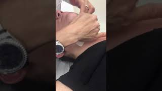 Kybella prep by Dr. Vu at Skinzone Medical