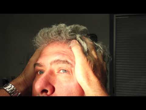 Positive Head Impulse test 3