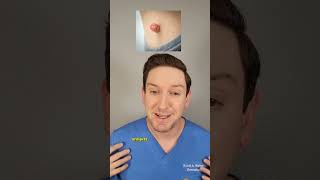 Dermatologist explains SKIN TAGS: What are they? Do they need to be removed? #skintags #derm