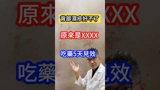 背部濕疹好不了⁉️原來是長這個😱 #皮膚科醫師 告訴你吃藥五天見效‼️#吳仁欽皮膚科診所 #毛囊炎 #痘痘 #醫皮痘 #艾克痘 #A酸 #藍雷射 #抗生素 #丘疹 #膿皰 #痤瘡 #癢疹 #搔抓