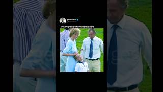 Reason for William's baldness🤣 #diana #princessdiana #fypシ゚viral #shorts #royalfamily #edit #history