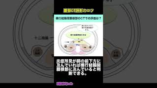 横行結腸間膜根部はCT画像でどう評価する？急性膵炎のCT grade評価で重要【腹部CT読影のコツ】#shorts