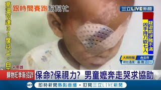 高雄3歲童左眼罹患"視網膜母細胞瘤"摘除...僅剩右眼竟也癌變 搶救僅存"光明"！嬤急籌百萬赴日本治療醫療費│記者 古芙仙 連冠智│【LIVE大現場】20201114│三立新聞台