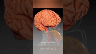"Brain-Eating Amoeba: The Deadly Infection of Naegleria fowleri"#shorts #education