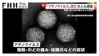 百日ぜき以外も…”アデノウイルス”流行で大人も感染「日常生活もきつい」発熱や結膜炎などの症状