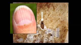 CFRU 2018 Webinar Series #1: Spruce Budworm Monitoring and Early Intervention Strategies