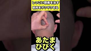 頭痛の原因、後頭下筋をザクザク切ります