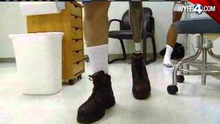 Bionic Knee Helps Injured War Vet