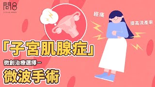 「子宮肌腺症」微創治療選擇－微波手術