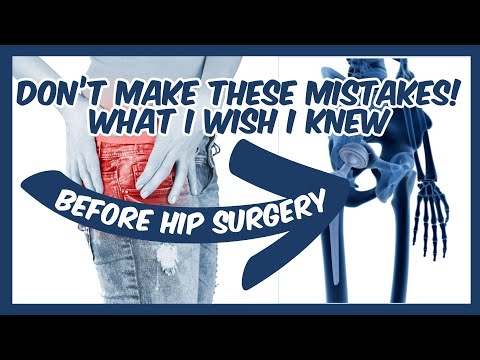 What I Wish I Knew Before Hip Replacement Surgery – New Book | Hip Replacement Surgery