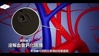 🤔您的血管年齡是多少呢？護管素逆轉您血管的年齡