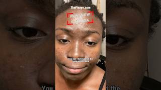 Skincare journey in Canada pt 4 #canadainfluencer #skincaretreatment #Jesusbaby #Vancouverinfluencer