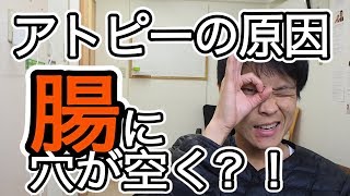 アトピーは腸に穴が空く？！　【アトピー、原因、リーキーガット症候群】