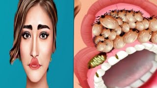 Asmr lips swollen caused by lice ticks infected mouth Treatment deep dirty mouth cleaning animation
