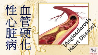 血管硬化性心脏病 Angiosclerosis Heart Disease