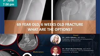 Pragmatic Orthopaedics: Delayed presentation of Proximal Humerus Fracture