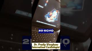 #echo #health #medicalmotivation #trendingshorts