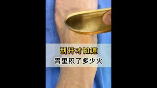 #学习中医 #调理身体 #中医养生 #中医