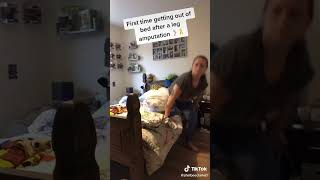 After amputation,  when you wake up, #limbloss #ampute