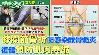 "膝關節骨折"防骨頭感染釀骨髓炎 復健防"肌肉萎縮" 健康2.0