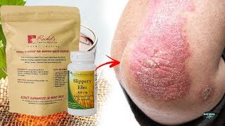 Slippery Elm Surprising Health Benefits