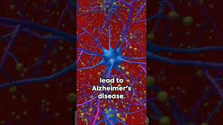 Nighttime Brain Detox: Why Sleep Matters 💤🧠 #lifestyle #dailywins #shortssuccess #habitbuilding