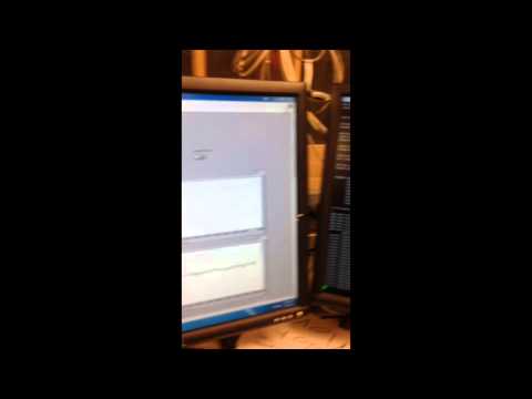 Acceptable Error Margin