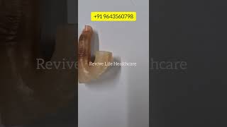 #amputeelife #shorts #viralvideo #viralshorts #9643560798 #hand #leg #amputee