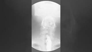 Barium - The Element of Brightness and Health