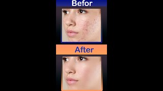 How to clean face and pimples remove adobe photoshop 2022 #shorts #igd_tips