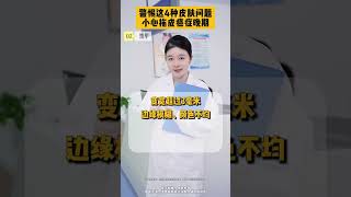 身上这4种表现，小心发展成皮肤癌！ #抖出健康知识宝藏  #皮肤 #癌症 #皮肤癌 #痣