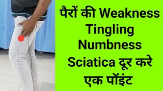 single Acupressure Point for legs thigh pain sciatica muscle weakness tingling numbness GB 31#shorts