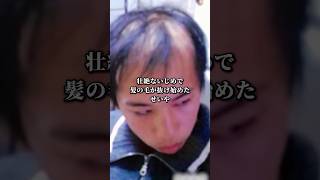 いじめのせいで禿げまくったせいや　#感動